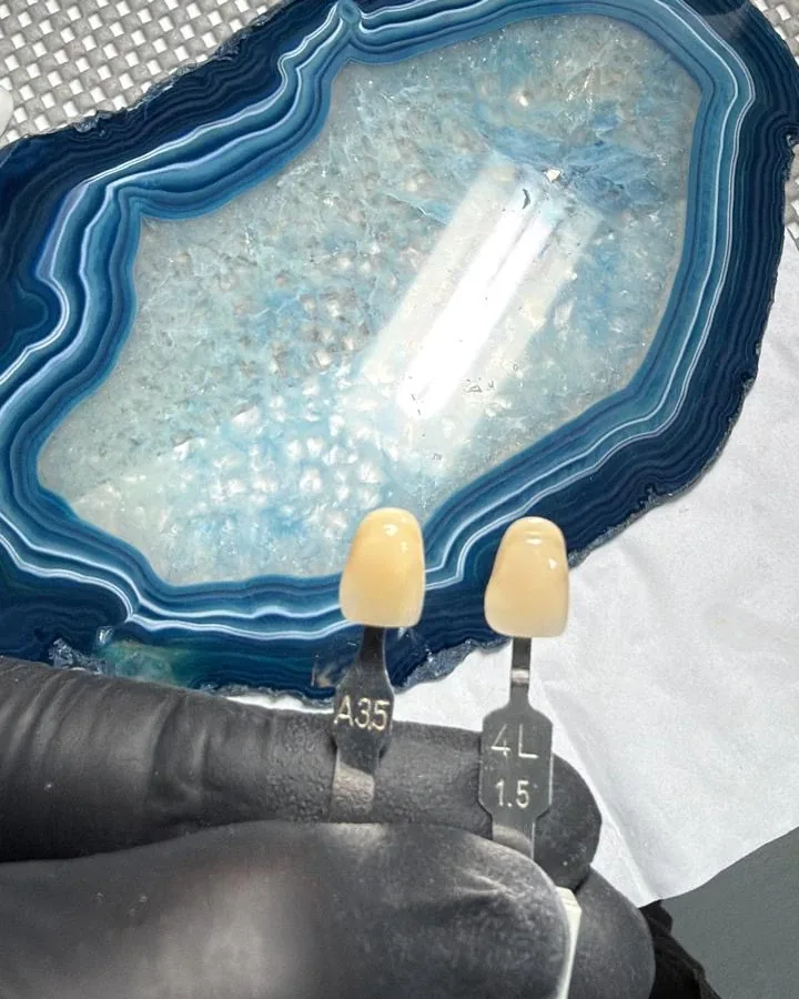 Dos guías de color, A3.5 y 4L1.5, comparadas sobre una placa de ágata azul en el laboratorio
